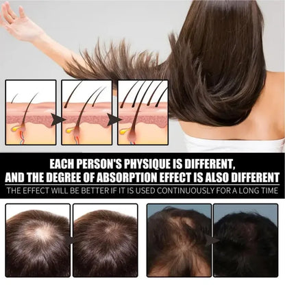 FORT Minoxidil Hair Growth Spray