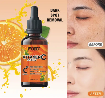 FORT Vitamin C Serum 30ml