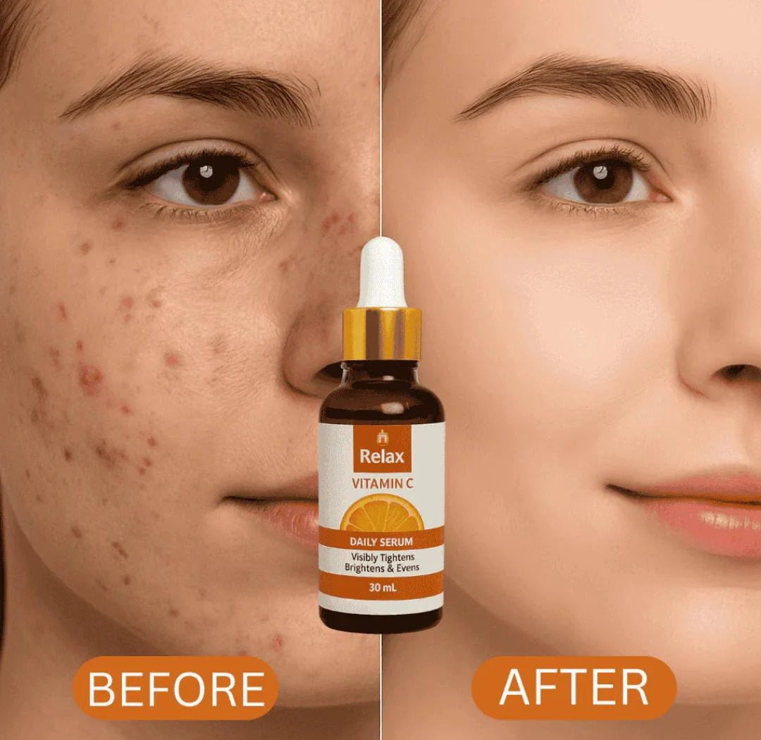 Relax Vitamin C Daily Face Serum – Brightening, Anti-Aging & Hydrating Formula (30 ml)