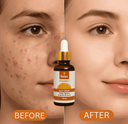 Relax Vitamin C Daily Face Serum – Brightening, Anti-Aging & Hydrating Formula (30 ml)