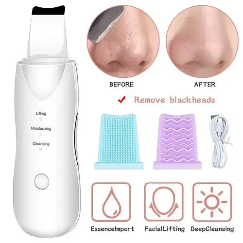 Deep Cleansing Blackhead Remover