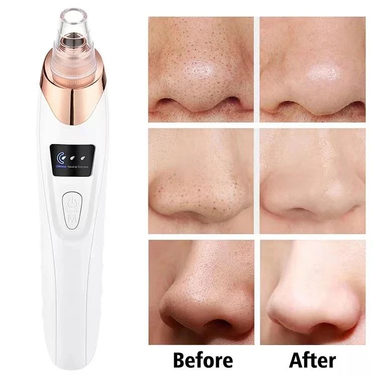Blackhead Remover Vacuum Facial Pore Cleaner