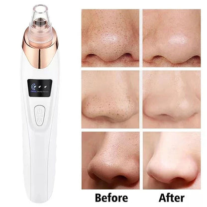 Blackhead Remover Vacuum Facial Pore Cleaner